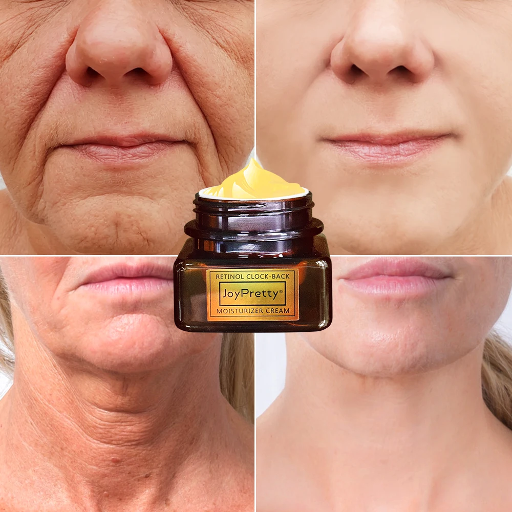 

JoyPretty Retinol Serum Anti Wrinkle Fade Fine Lines Dark Spots Firmer Moisturizing Hyaluronic Acid Face Serum Skin Care 50ml