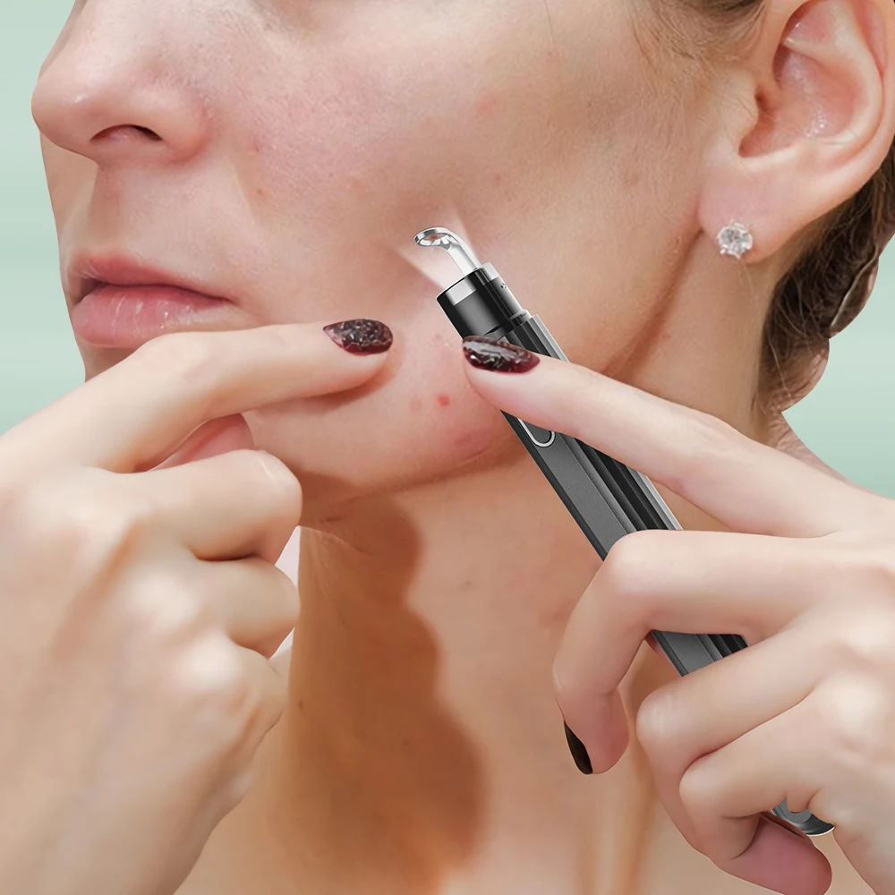 Умный визуальный аппарат для удаления черных точек средство игла косметическое