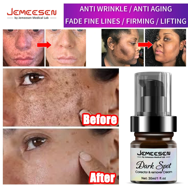 

Jemeesen Dark Spot Remover Spot Corrector Cream Skin Care Moisturizing Brighten Pigment Correction Face Beauty Whitening Freckle