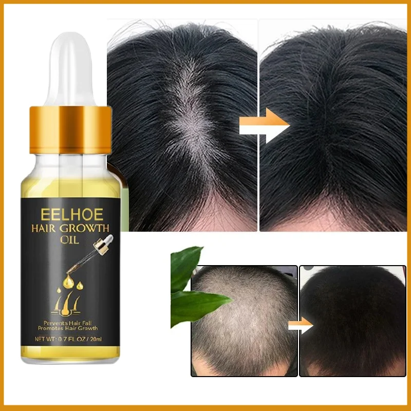 

Fast Hair Growth Essential Oil Prevent Baldness Scalp Hair Root Damaged Treat Germinal Regrowth Liquid Anti Hair Loss Products