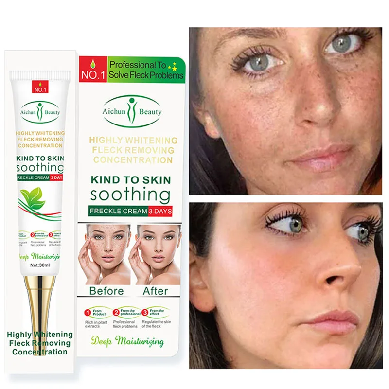 

Effective Whitening Freckle Cream Gel Remove Melasma Acne Spot Pigment Melanin Dark Spots Pigmentation Moisturizing Skin Care