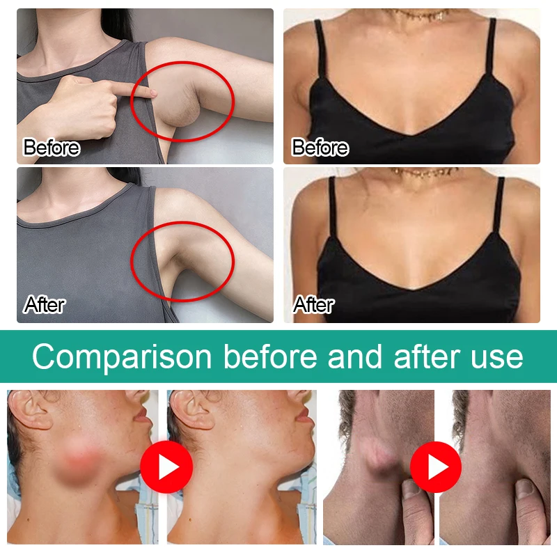 6 шт./1 упаковка травяные Пластыри для лимфатического дренажа