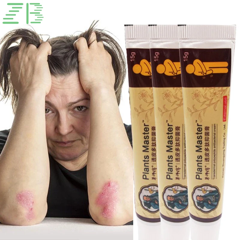 

ZB искусственная мазь для лечения псориаза, средство для лечения неприятного запаха для рук и ног, ингибитор дерматита, грибка, крем против зуда