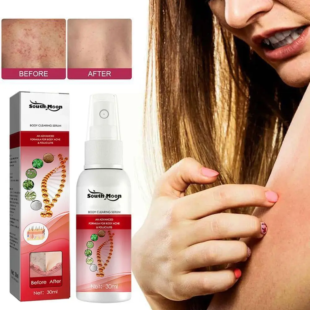 

Hair Follicle Net Spray To Suppress Hair Follicle Growth And Itching Spray Chest Itching Redness Back G1o6