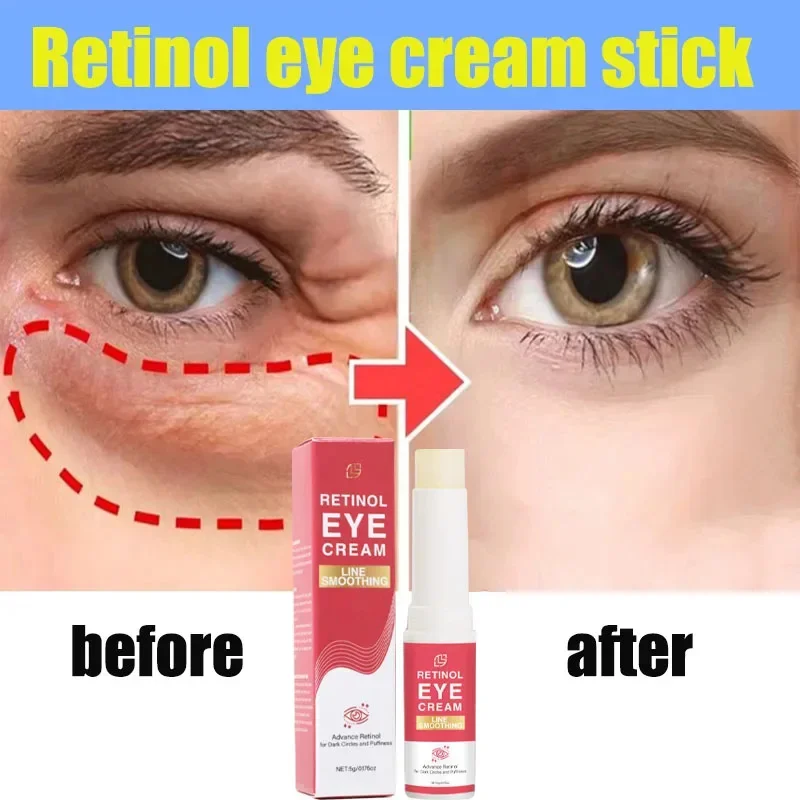 Крем для области вокруг глаз от морщин припухлости и тёмных кругов