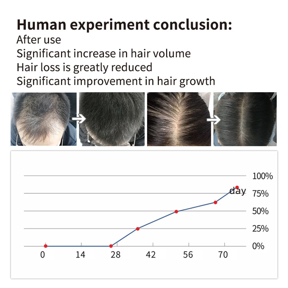 HAIRCUBE Ginger эфирное масло для роста волос против выпадения жидкий спрей натуральный