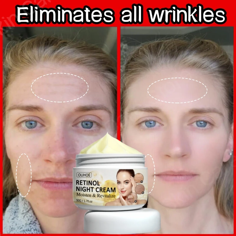 

Retinol Wrinkle Removing Cream Instant Firming Lifting Anti Aging Fade Fine Lines Moisturizing Brighten Korean Original Skincare