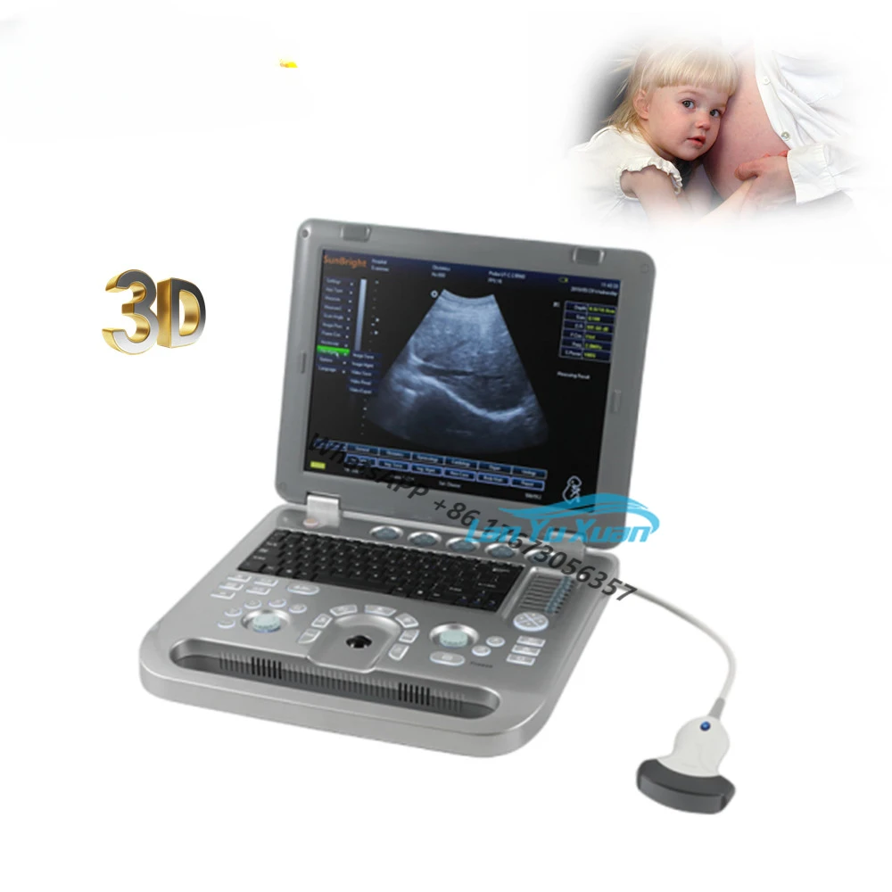 

Laptop Ultrasound Scanner B/W 3D Ultrasound Machine SUN-800D Pc Based with Discount Price