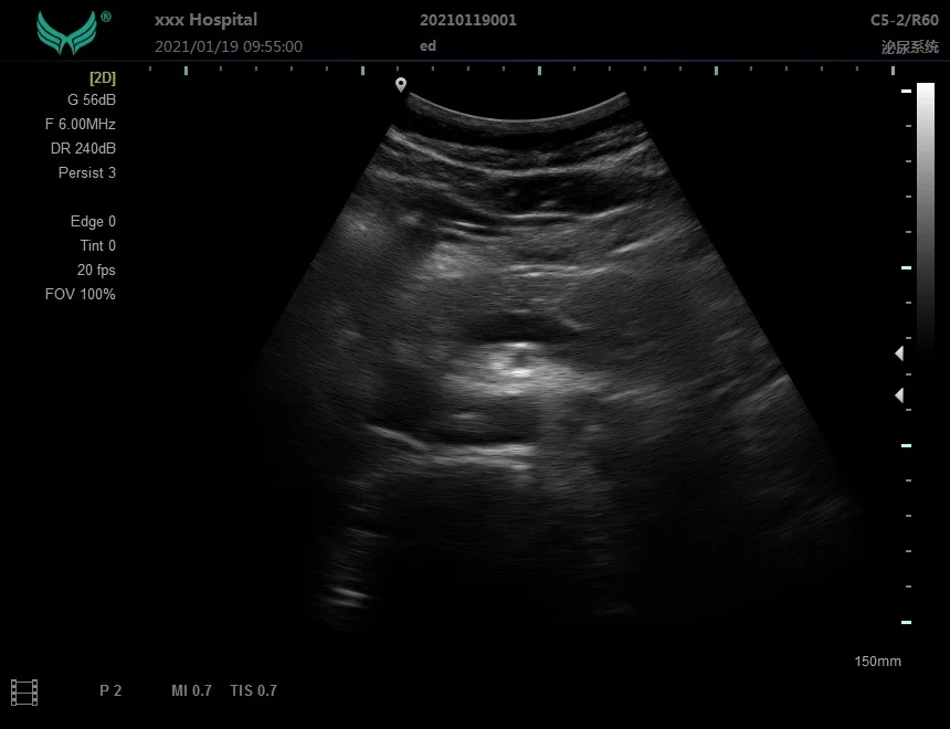 Ноутбук YD-P20 B/W ультразвуковая диагностическая система портативная цена
