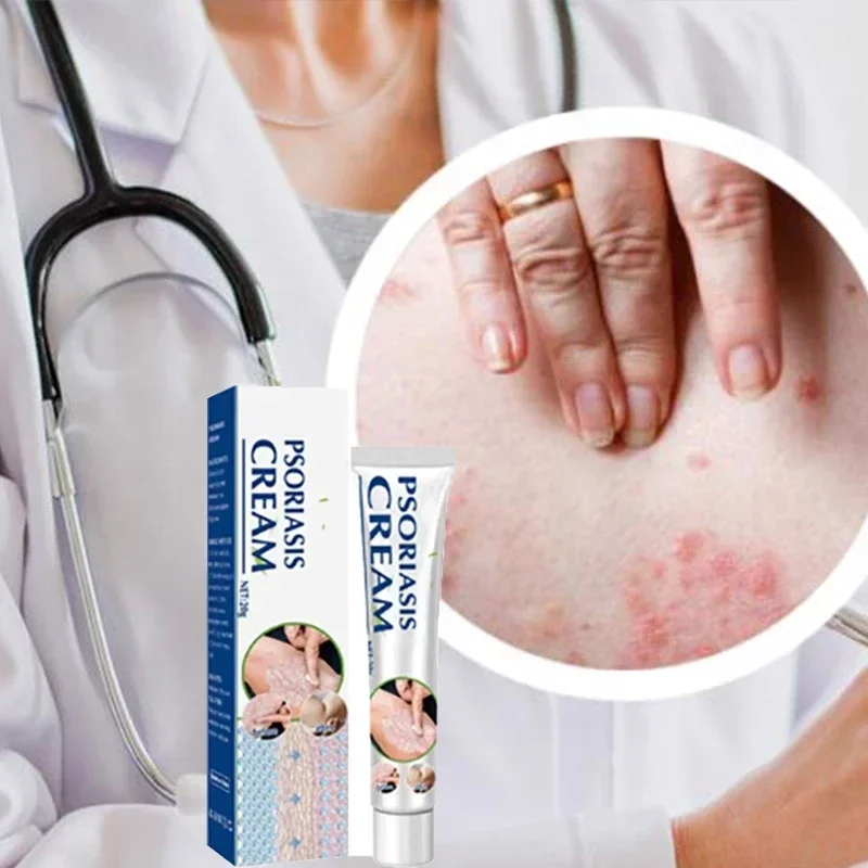 Новый лучший продукт против дерматита при псориазе и экземе Лечение: натуральный