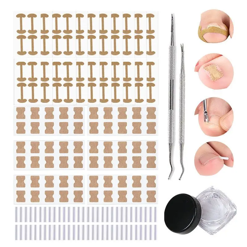 

1Set Nail Correction Stickers Toenail Braces Toenail File Dead Skin Fork Paronychia Treatment Recover Corrector Pedicure Tools