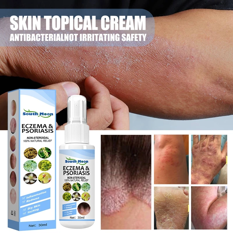 30ml Herb Essence Skin Psoriasis Spray Antibacterial Spray Dermatitis Eczematoid Eczema Ointment Treatment Foot Relieve Itching