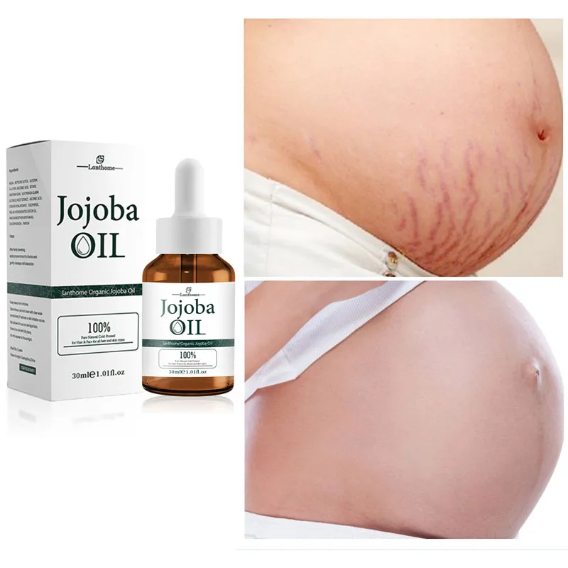 

Pregnancy Stretch Marks Remover Scar Removal Jojoba Oil Maternity Skin Repair Anti-Winkles Firming Body Massage Oils 30ml