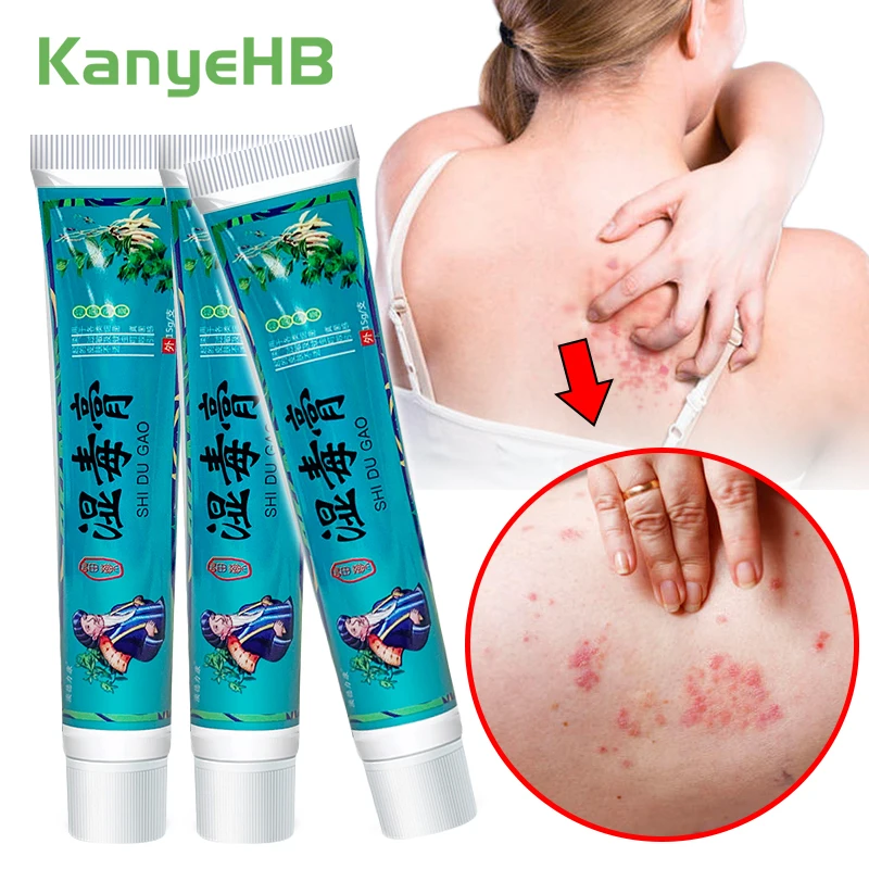 

3pcs Psoriasis Ointment Relief Skin Itch Repair Skin Eczema Dermatitis Cream Beriberi Inhibits Fungi Cream Home Essentials A1183