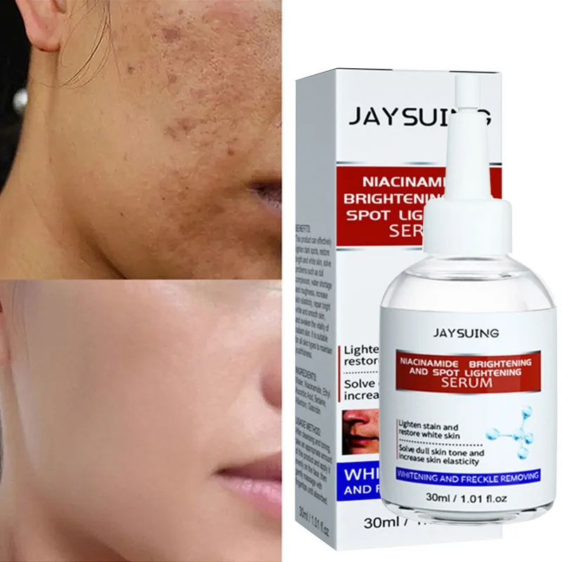 

Nicotinamide Face Whitening Essence Removing Black Spot Melanin Moisturizing Brighten Increase Skin Elasticity Face Skin Care