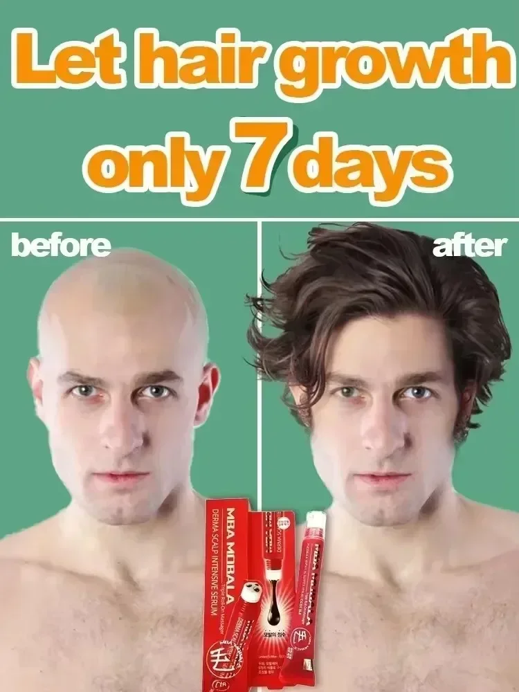 Сыворотка для быстрого роста волос восстановление облысения наследственный