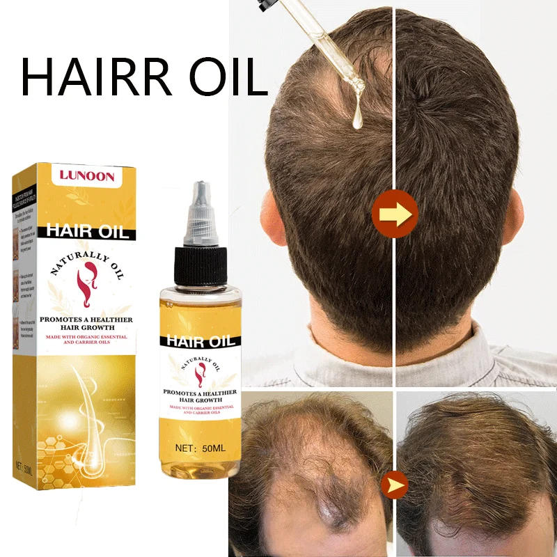 

Hair Growth Oil Fast Grow Prevent Hair Loss Hair Dry Frizzy Damaged Thinning Repair Thicker Hair Care Scalp Treatment Product