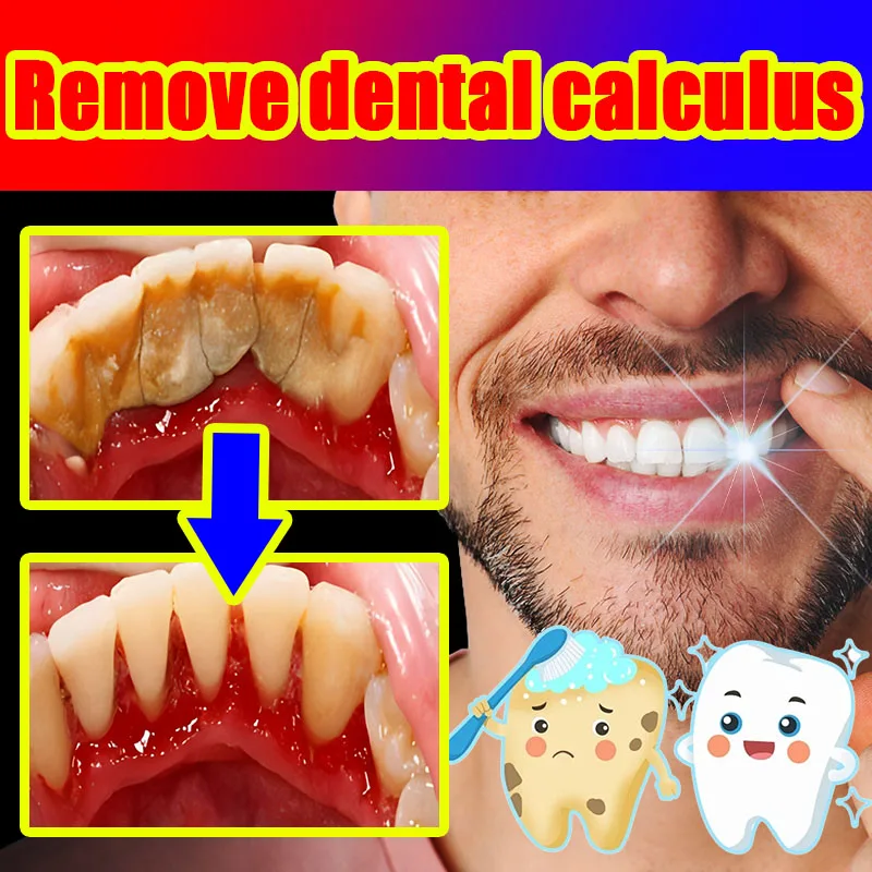Зубчатая паста для удаления заусенцев Бесплатная доставка
