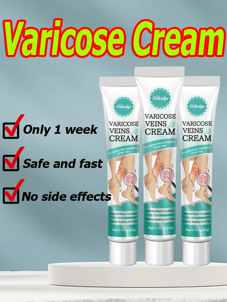 Помада для veias varicosas alivia Fiskmente как и vasculite flebite