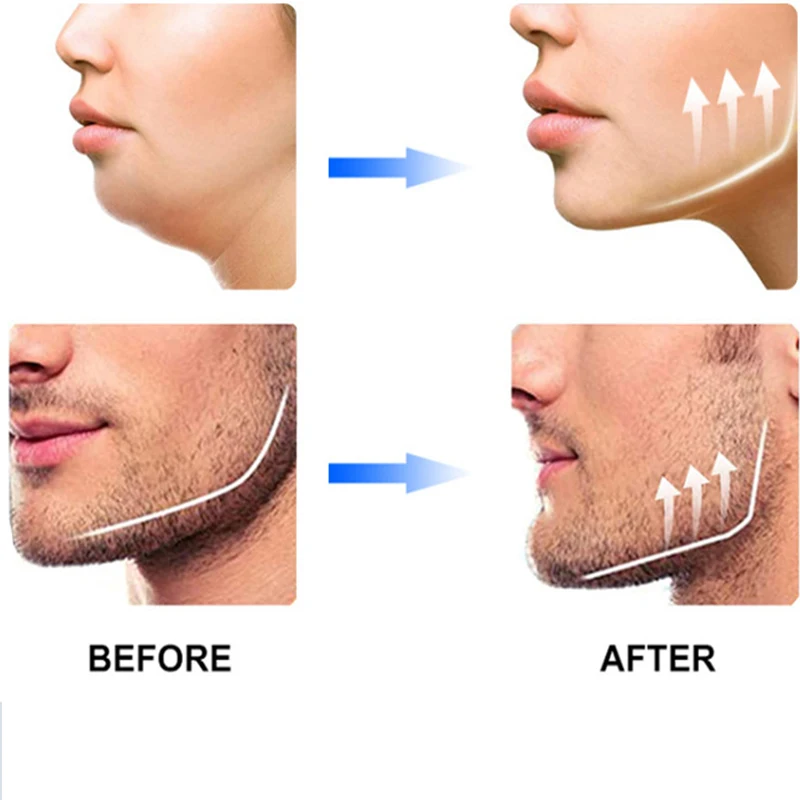 Силикагелевый тренажер для челюсти AliExpress