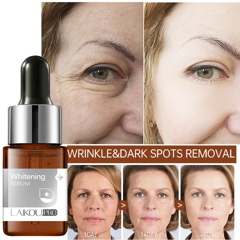 Effective Whitening Serum Niacinamide Remove Facial Dark Spots Melasma Fade Fine Lines Anti-aging Essence Nourish Skin Care