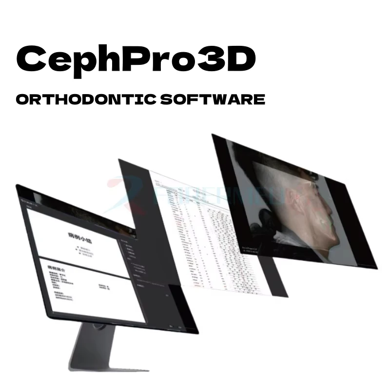 Фото Интеллектуальный 3D CBCT панорамный рентген-аппарат для стоматологии, универсальный дентальный цефалометрический рентген-аппарат №3