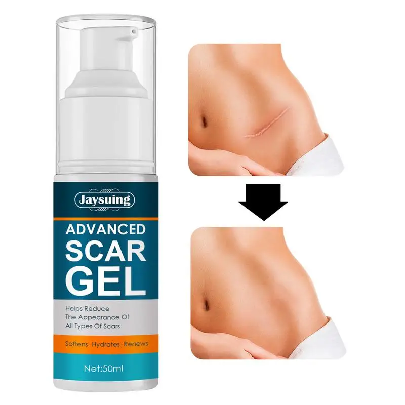 

Scar Removal Gel For Women And Men Face & Body Skin Scar Reduce & Repair Cream For C-Section Tummy Tuck Acnes Spots Burns And