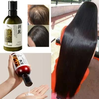 1pc hair care product ginger anti hair loss hair growth serum shampoo effective hair loss treatment cool hair growth liquid