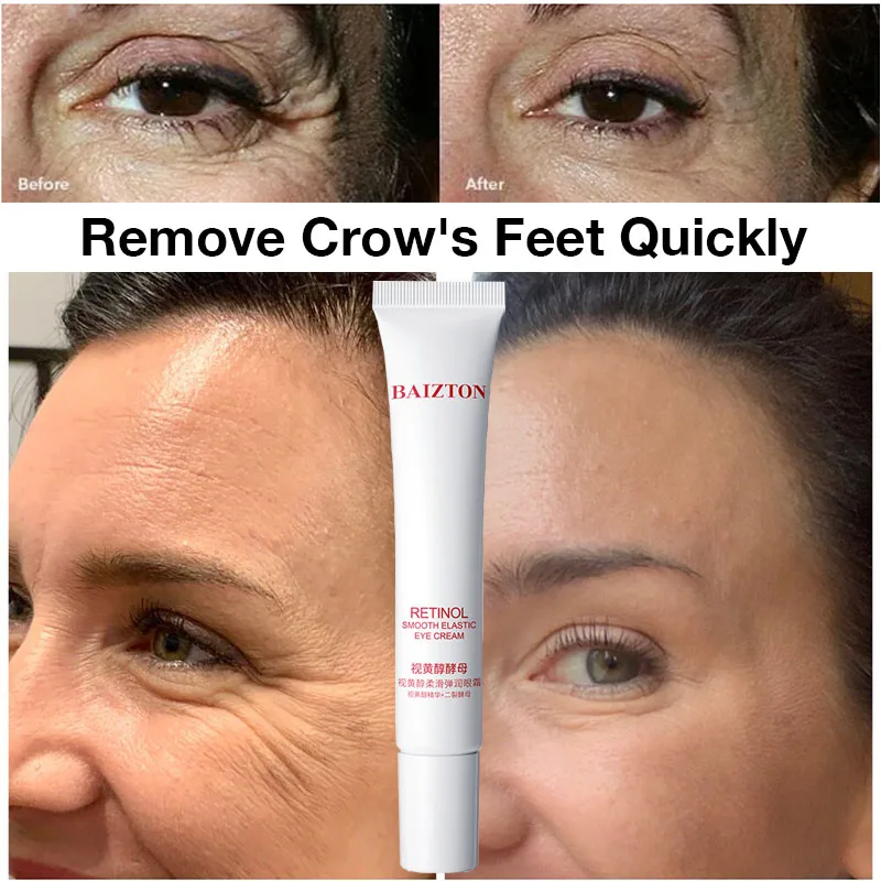 

Ретинол против морщин глаз, раннее старение, темные круги