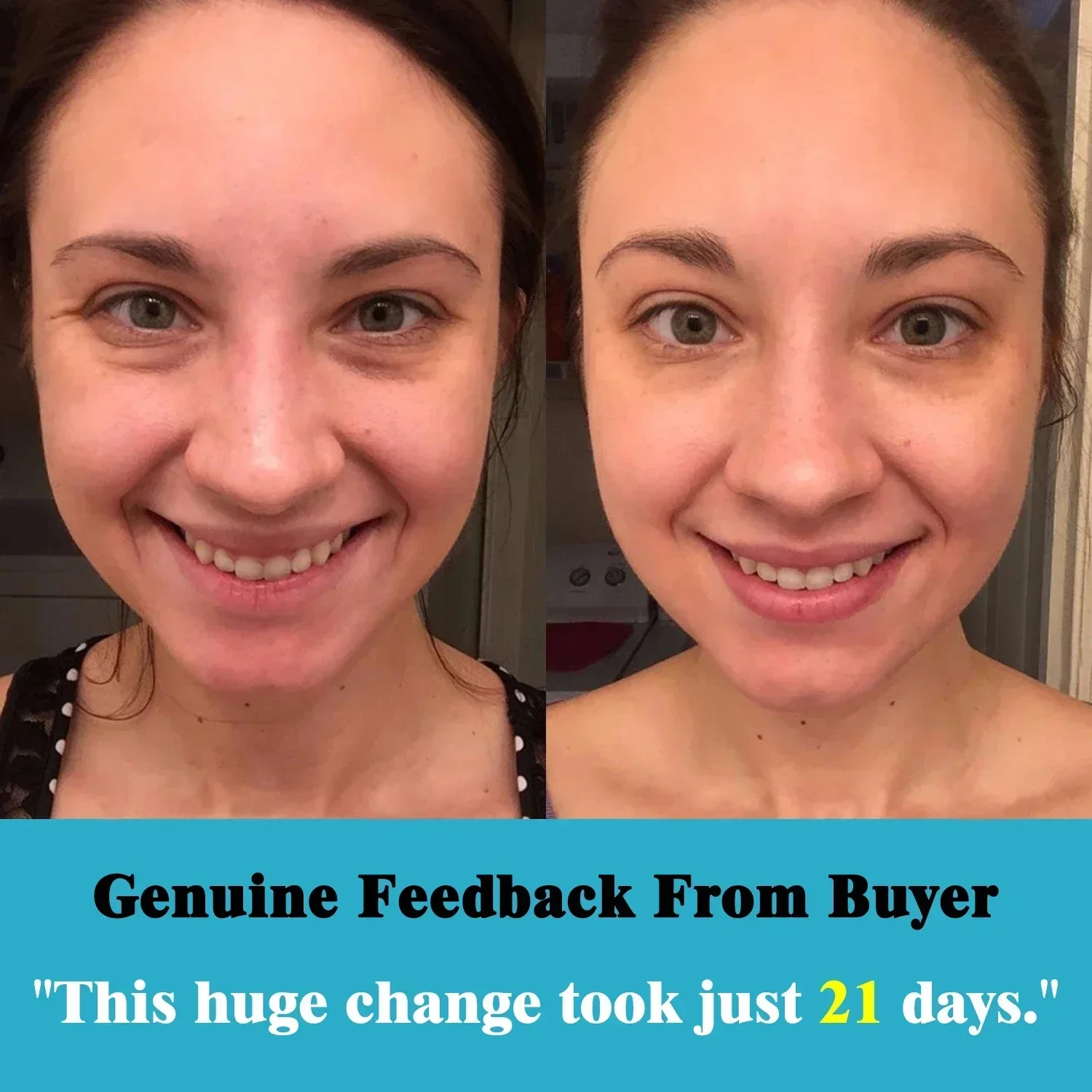 Отшелушивающая сыворотка с салициловой кислотой антивозрастное эфирное масло