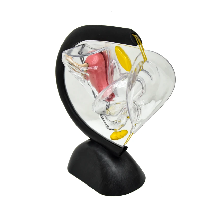 Анатомическая модель матки из ПВХ франк жирарди кольпоскопия и патология шейки матки по бургхардту