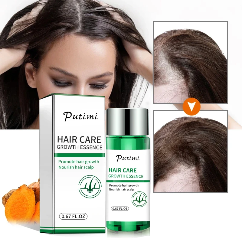 

Масло для роста волос Sdatter PUTIMI, быстрорастущее эфирное масло для волос, красота, уход за волосами, предотвращение выпадения волос, масло для ...