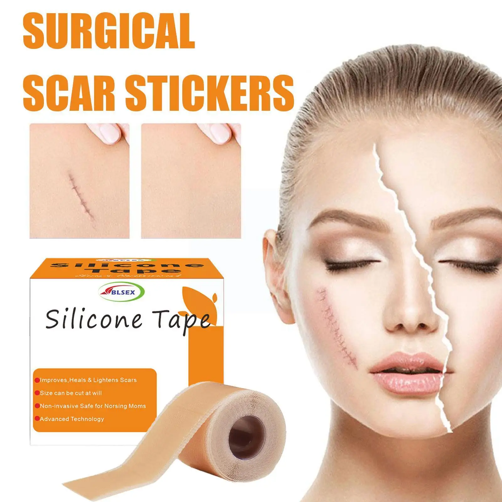 

1pcs 4*150cm Silicone Scars Patch Efficient Surgery Scar Removal Silicone Gel Sheet For Acne Trauma Burn Scar Skin Repair A9N2