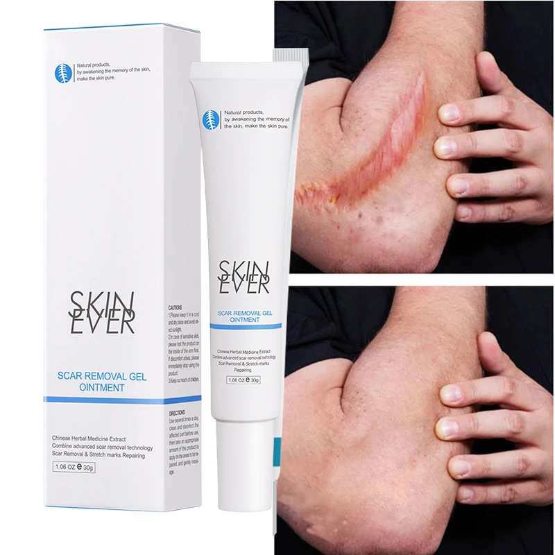

Scar Removal Cream Repair Stretch Marks Burn Acne Surgical Acne Scar Ointment Herbal Treatment Gel Whitening Beauty Health Care