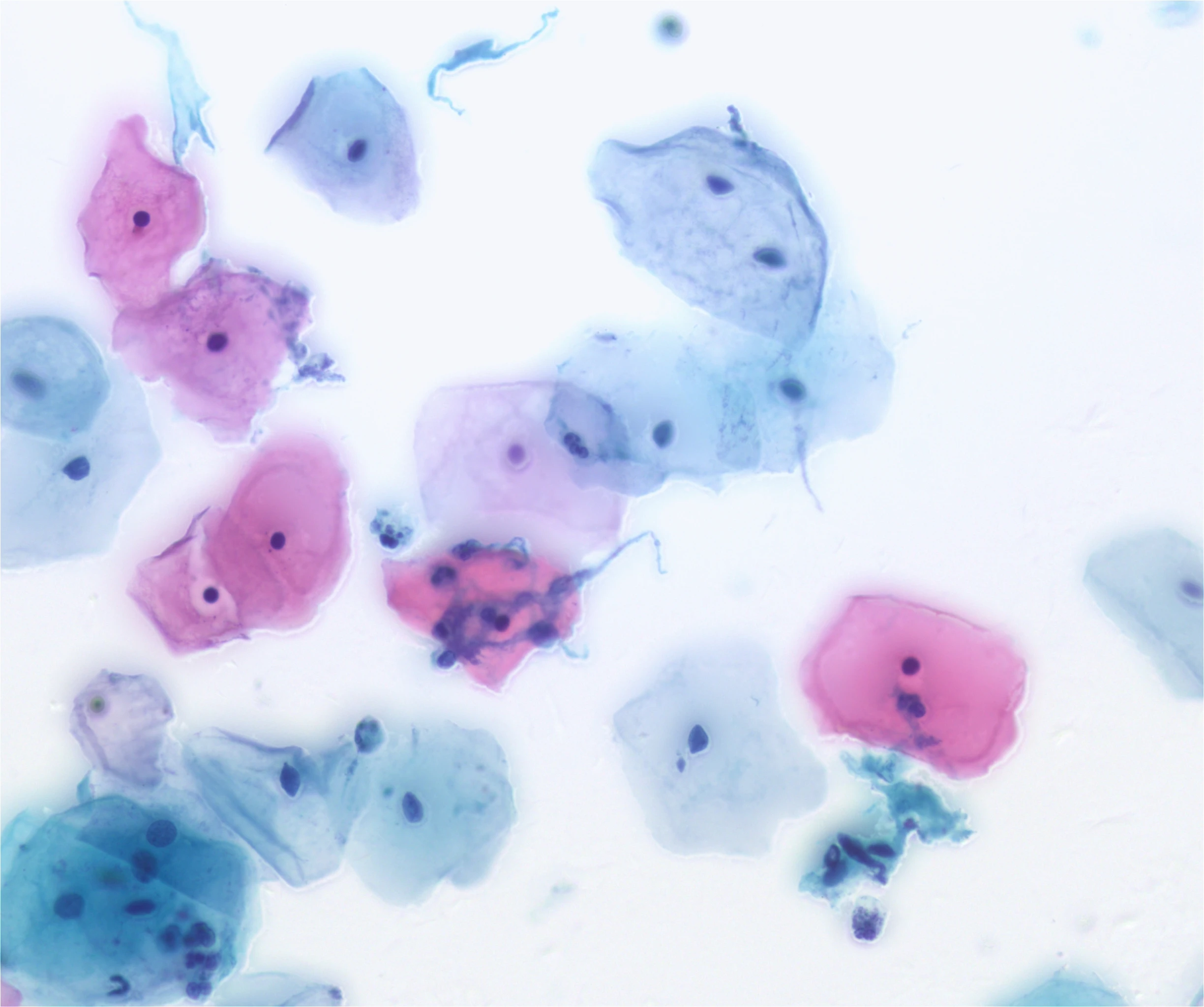 BestScope BUC5H-600C цифровая камера для микроскопа