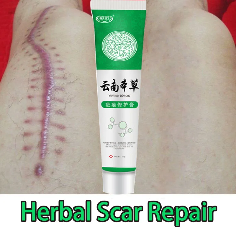 

Herbal Scar Removal Cream Gel Stretch Marks Remove Acne Spots Burn Surgical Treatment Smooth Whitening Face Body Skin Care
