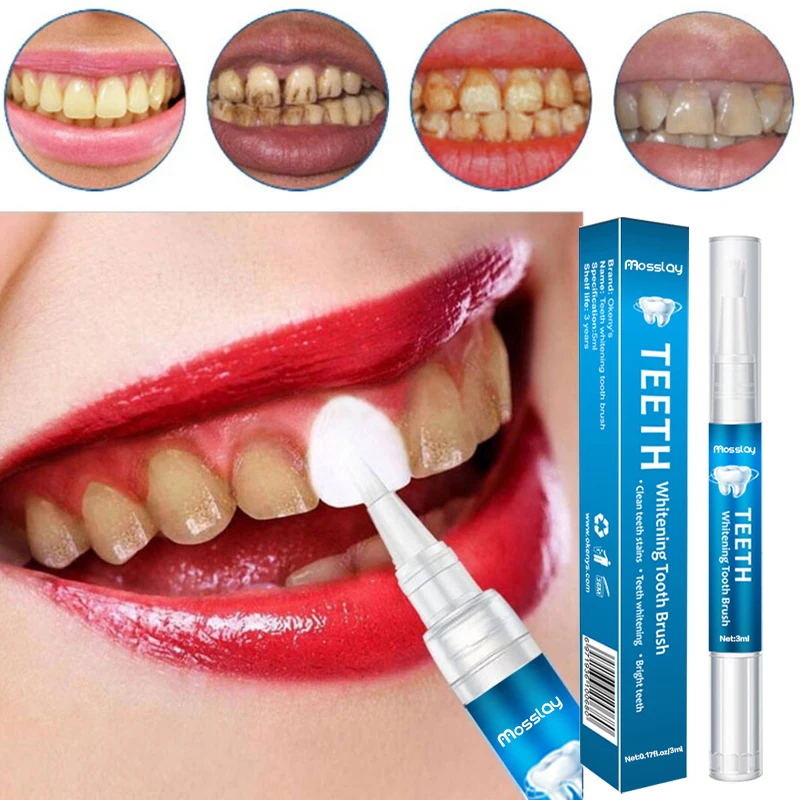 

Teeth Whitening Pen Remove Plaque and Tartar Clean The Mouth Tooth Brushing Essence MeiYanQiong Brush Teeth Tooth Decay
