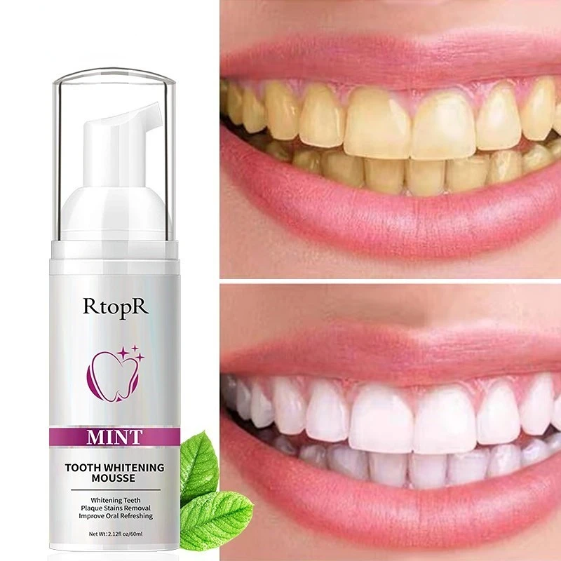 

60ml RtopR Teeth Cleansing Whitening Mousse Removes Stains Teeth Whitening Oral Hygiene Mousse Toothpaste Whitening & Staining