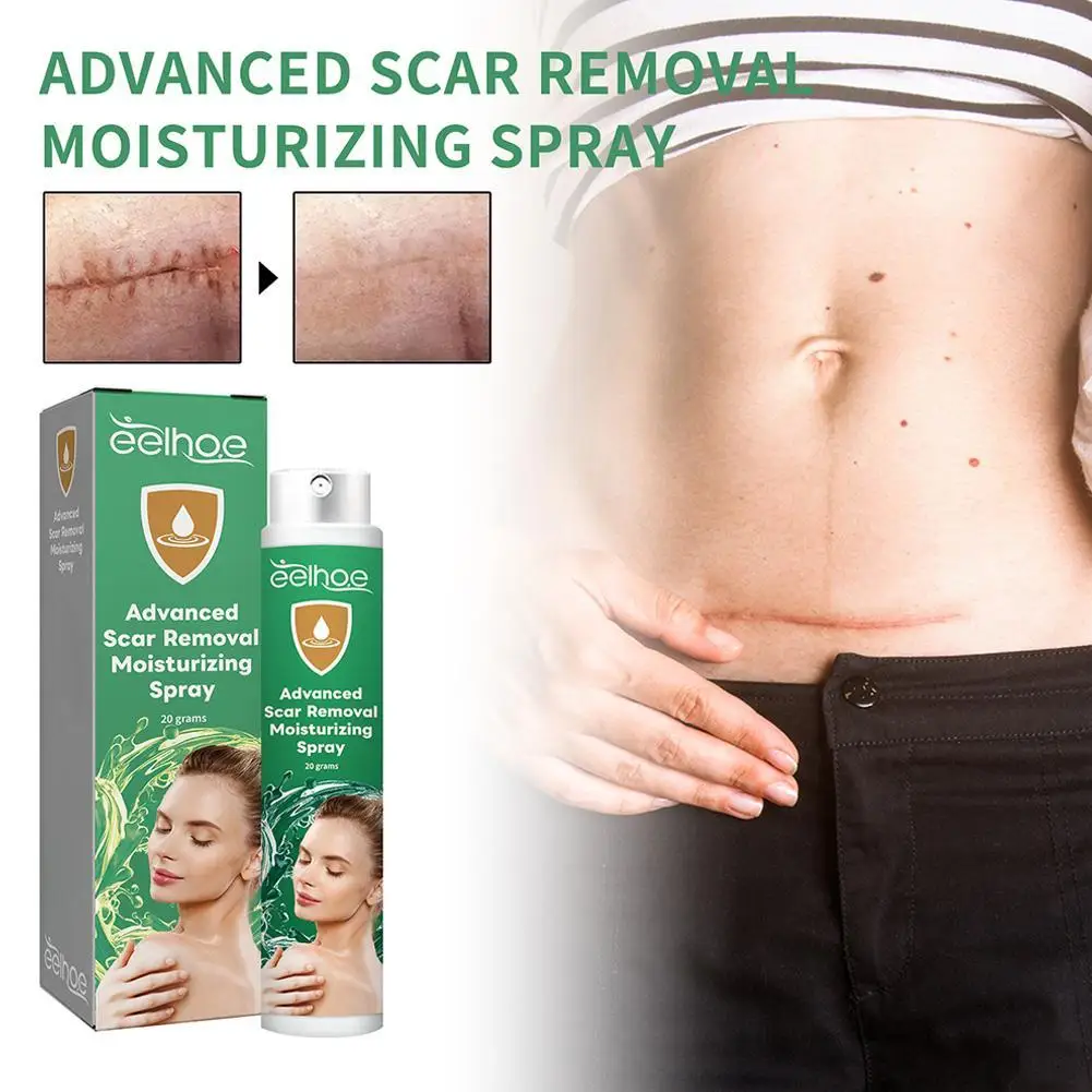 

Advanced ScarRemoval Moisturizing Spray Allantoin Extract Great Efficacy Increase Skin Practical For Men Women Body Care
