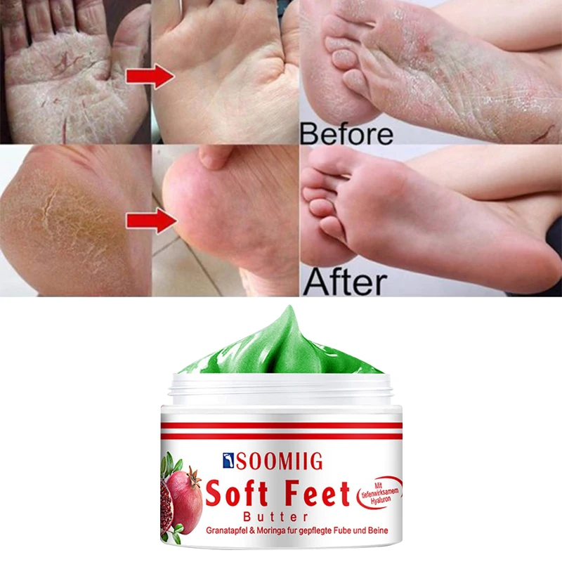 Рисунок 6 - Крем для ног с защитой от сухости и трещин