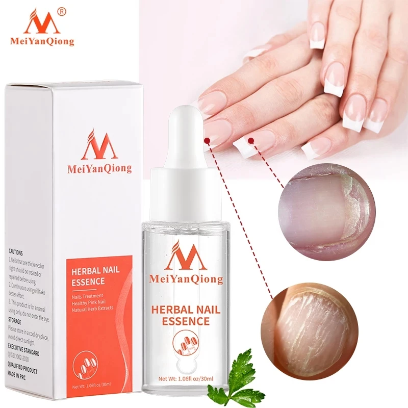 

6pcs/lot Fungal Nail Treatment Feet Care Essence Nail Foot Whitening Toe Nail Fungus Removal Gel Paronychia Onychomycosis 30ml