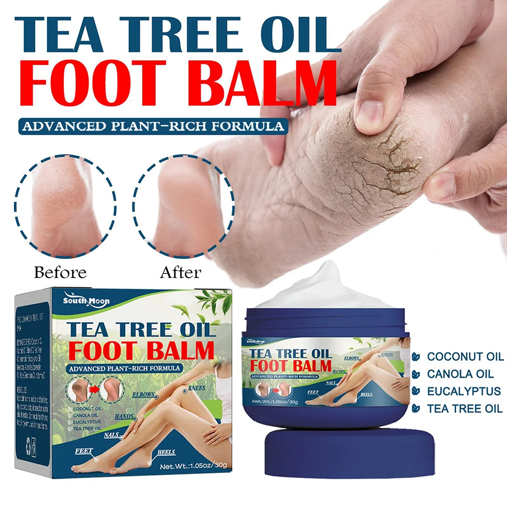

30g Hand Feet Care Balm Natural Ingredient Prevent Freezing Cracking Cream Moisturizing Repairing Soothes Skin For Women Men