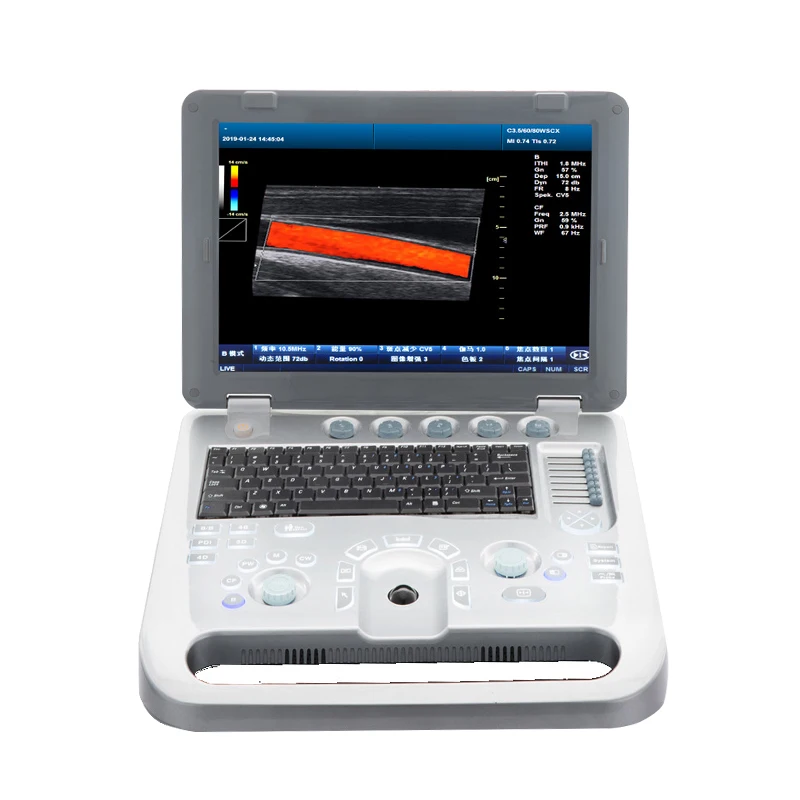 Ультразвуковой зонд Vscan Air диагностический беспроводной двойной машина для