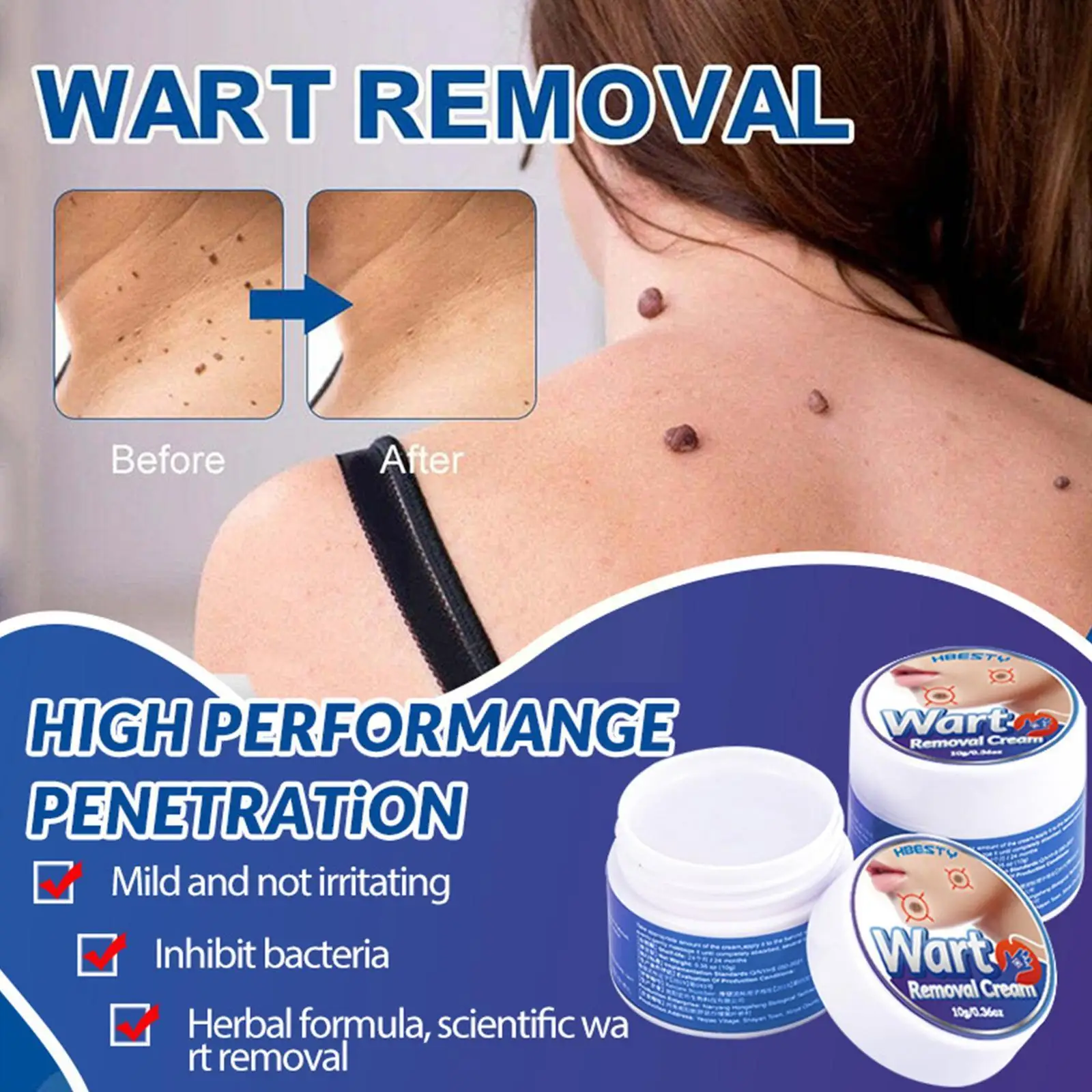 

Wart Remover Safe Painless Skin Tags Removal Cream For Warts Moles Corn Cure Remover Cream Plaster Warts Ointment Skin Care P4C7