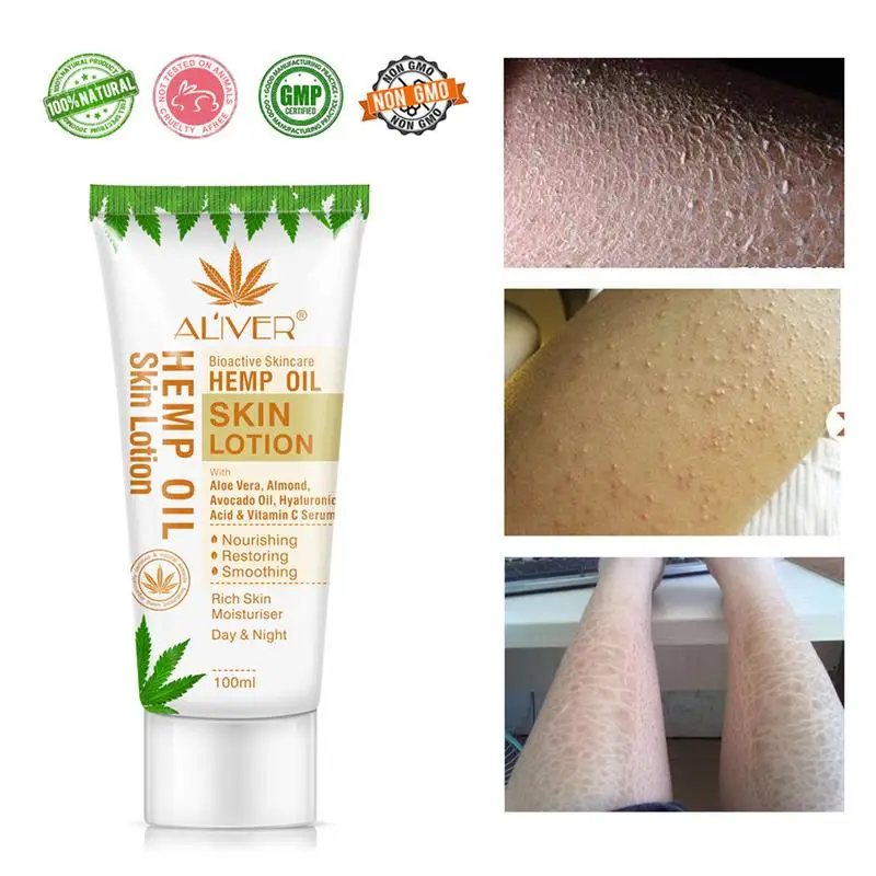 

Hemp Oil Skin Moisturizing Lotion | Body Skin Lotion Nourishing Moisturizing Care Cream For Women | Improve Skin Moisture