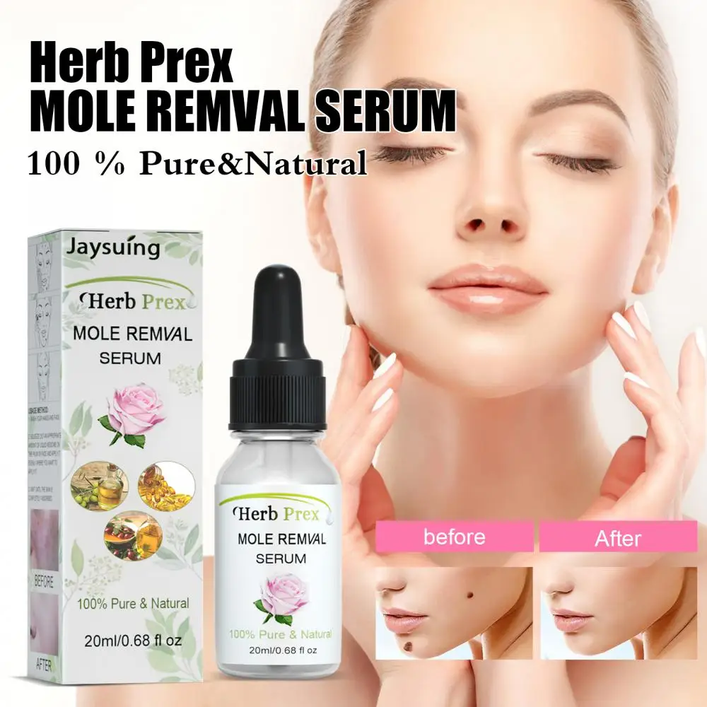 

Painless Skin Tag Remover Spot Nevus Moles Potion Rose Essential Oil Skin Label Freckle Warts Removal Skin Care Herbal Serum