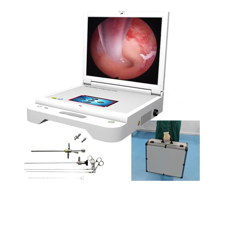 

All-in-one pc equipo medico histeroscopio portatil unit with histeroscopio instrument