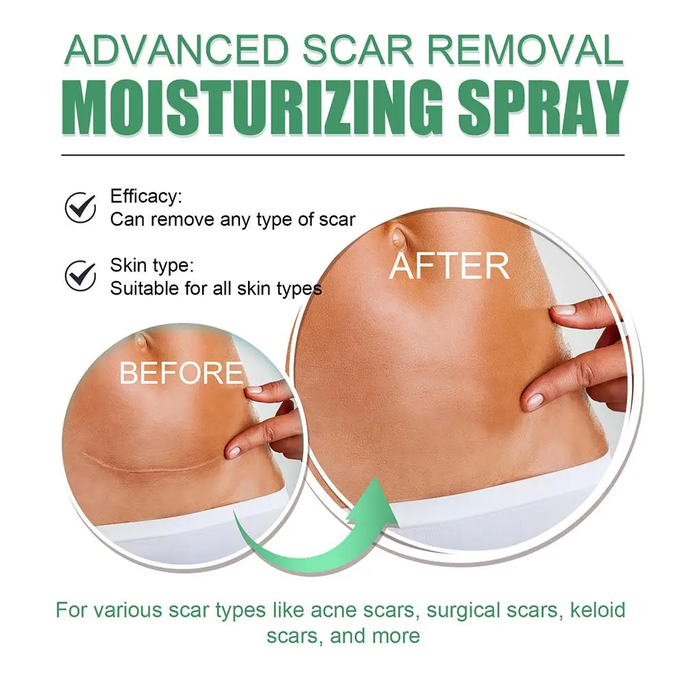 

Увлажняющий спрей для ухода за телом для мужчин и женщин