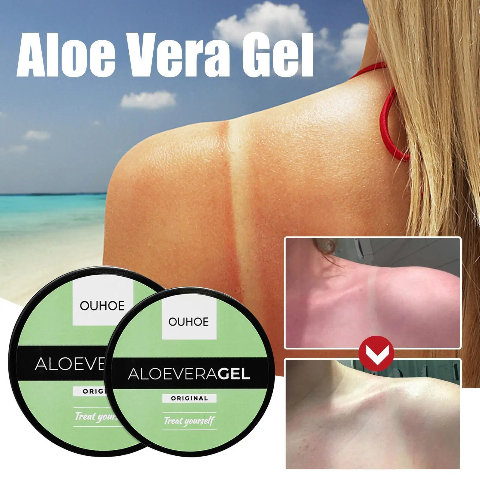 

50/100g Aloe Vera After Sun Repair Gel Anti Pimple Skin Moisturizing Repair After-Sun Care Anti-Inflammatory J6U2