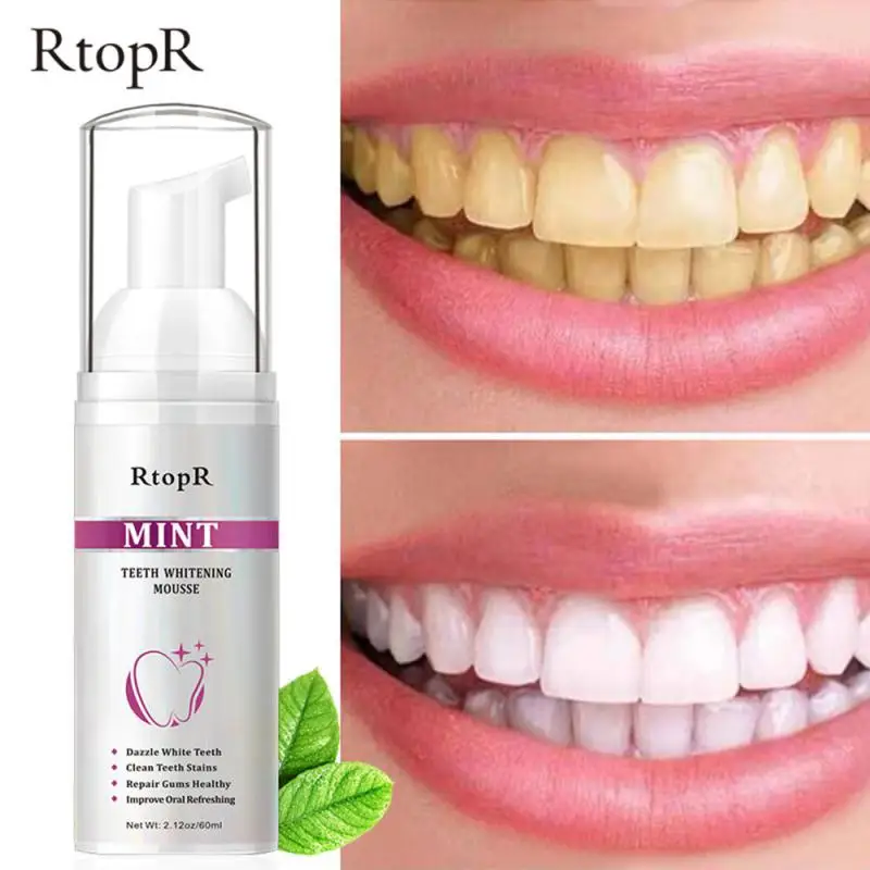 

RtopR Teeth Cleansing Whitening Mousse Removes Stains Teeth Whitening Oral Hygiene Mousse Toothpaste Whitening And Stain